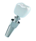 implante_dentário_animerodonto_curitiba